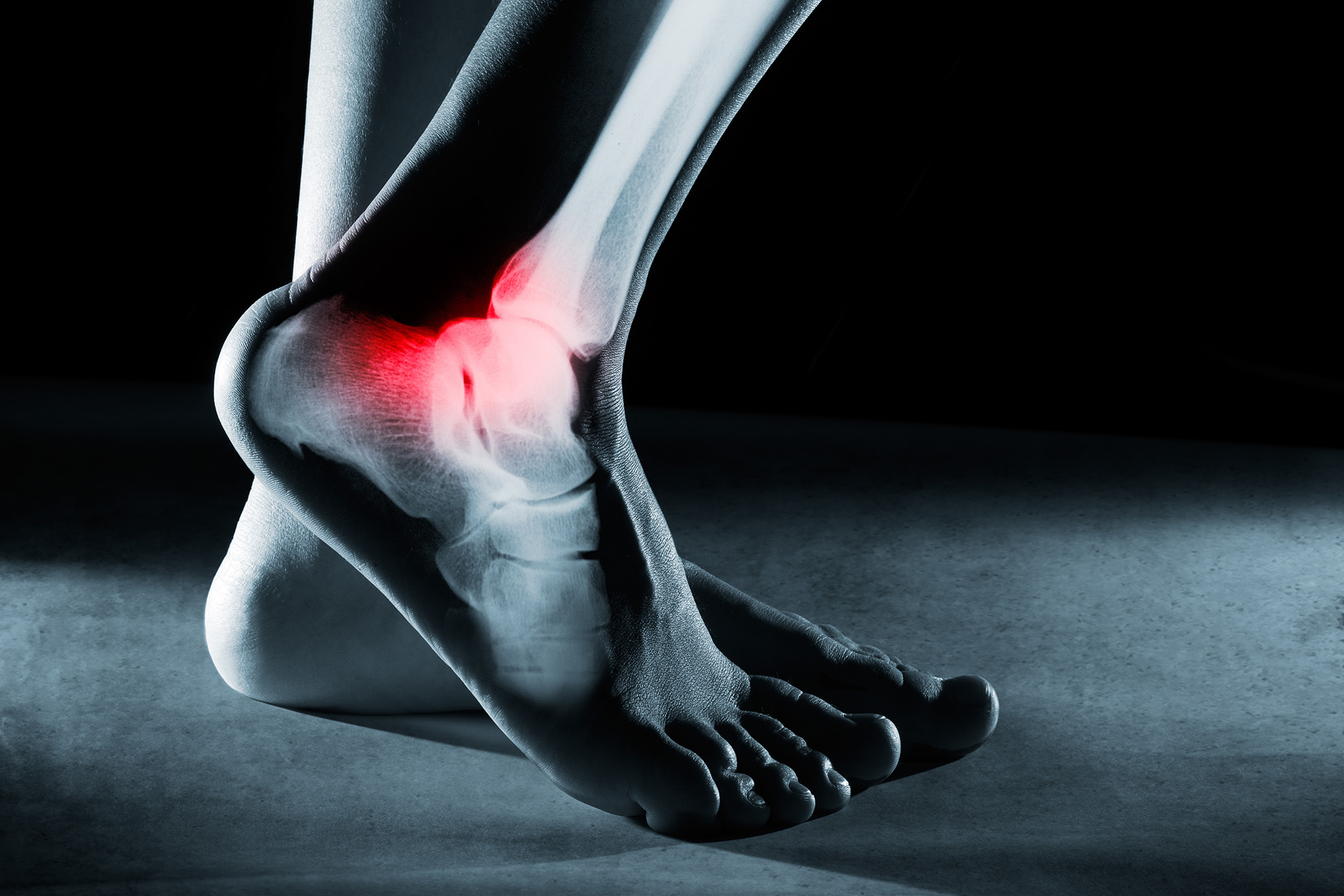 flat foot ankle pain