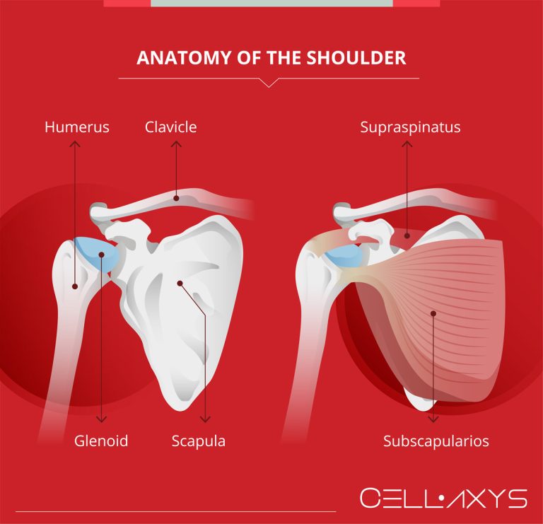 Shoulder Popping, No Pain A Symptom Of Something Worse Or A Benign Condition? Cellaxys