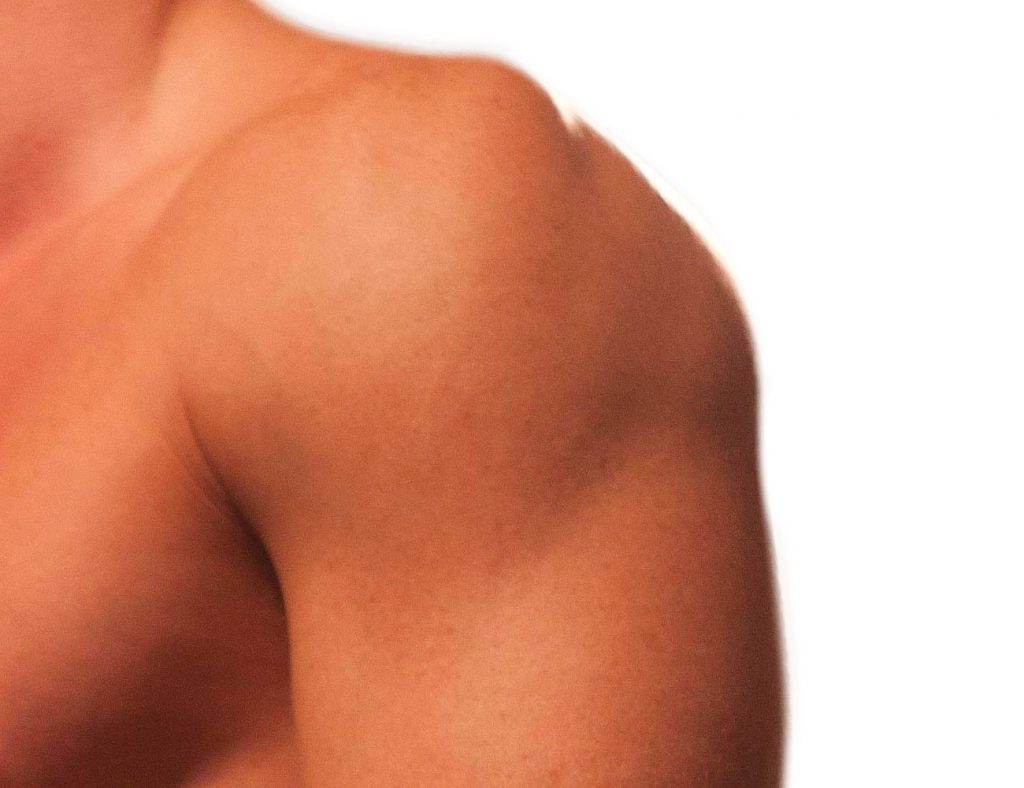 Shoulder Popping, No Pain A Symptom Of Something Worse Or A Benign Condition? Cellaxys