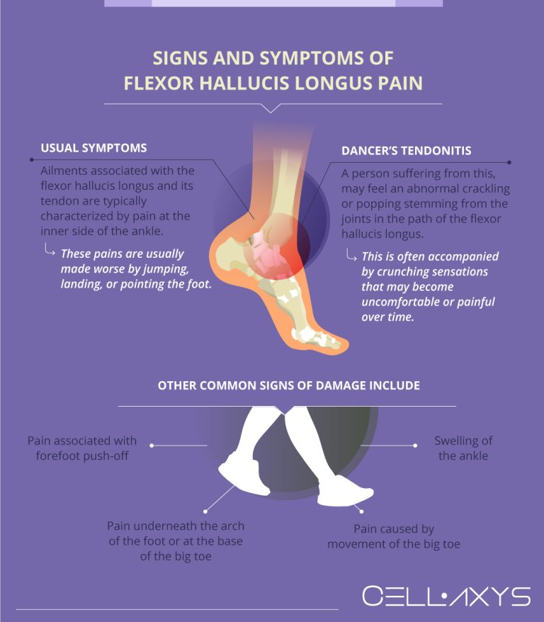 Flexor Hallucis Longus Pain – Anatomy, Diagnoses, And Treatment - Cellaxys