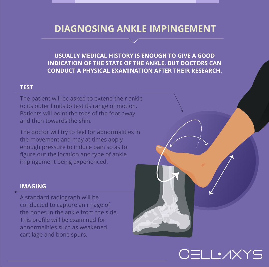 Sprained Ankle Recovery Time - Cellaxys