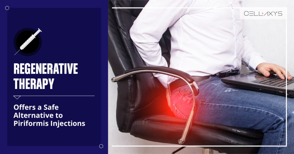 Piriformis Injections