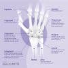 Ulnar Wrist Pain: Why Ulnar Shortening Osteotomy Is Not Ideal? - Cellaxys