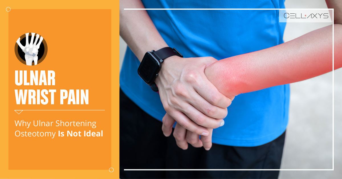 Ulnar Wrist Pain Why Ulnar Shortening Osteotomy Is Not Ideal Cellaxys