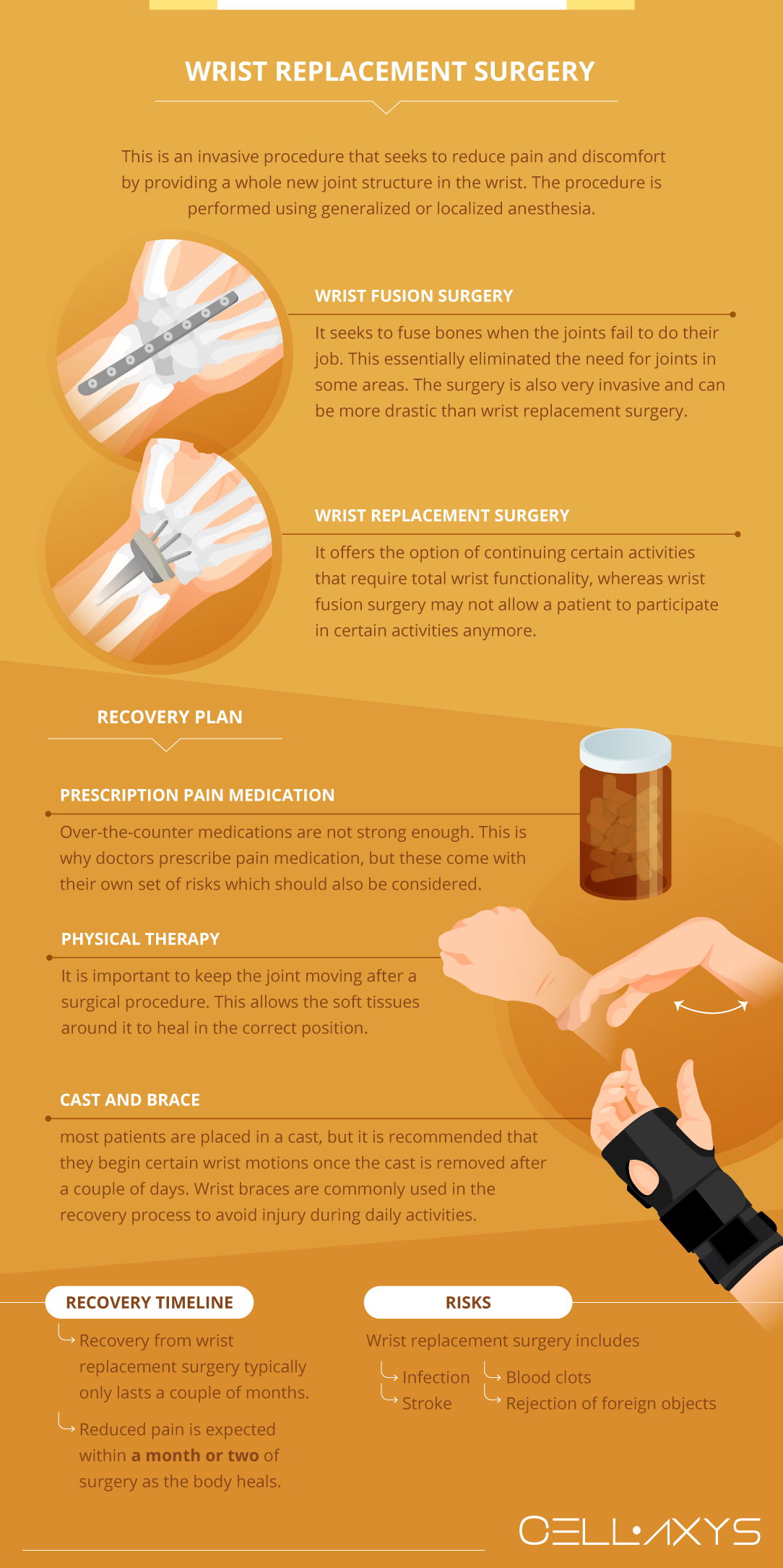 Wrist Replacement Surgery