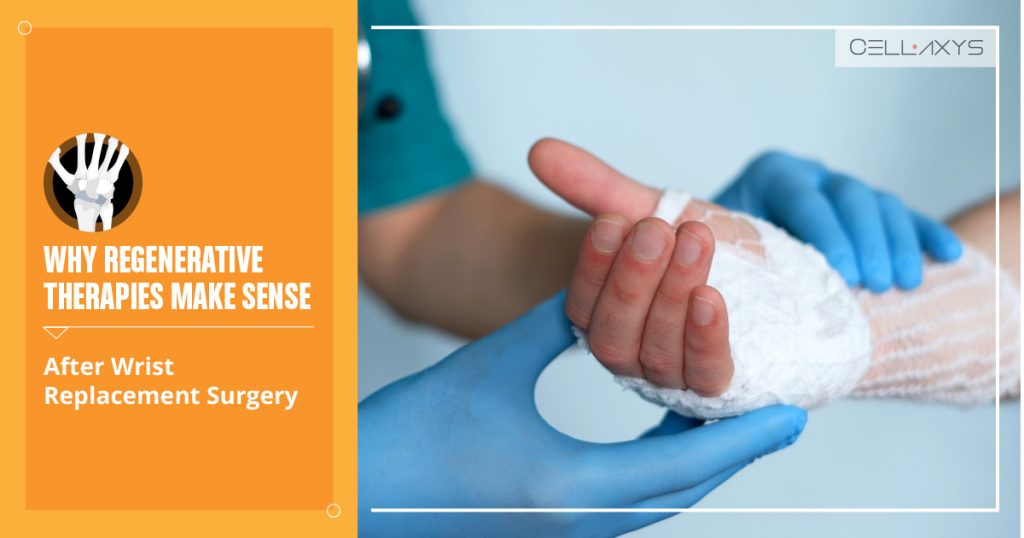 Wrist Replacement Surgery