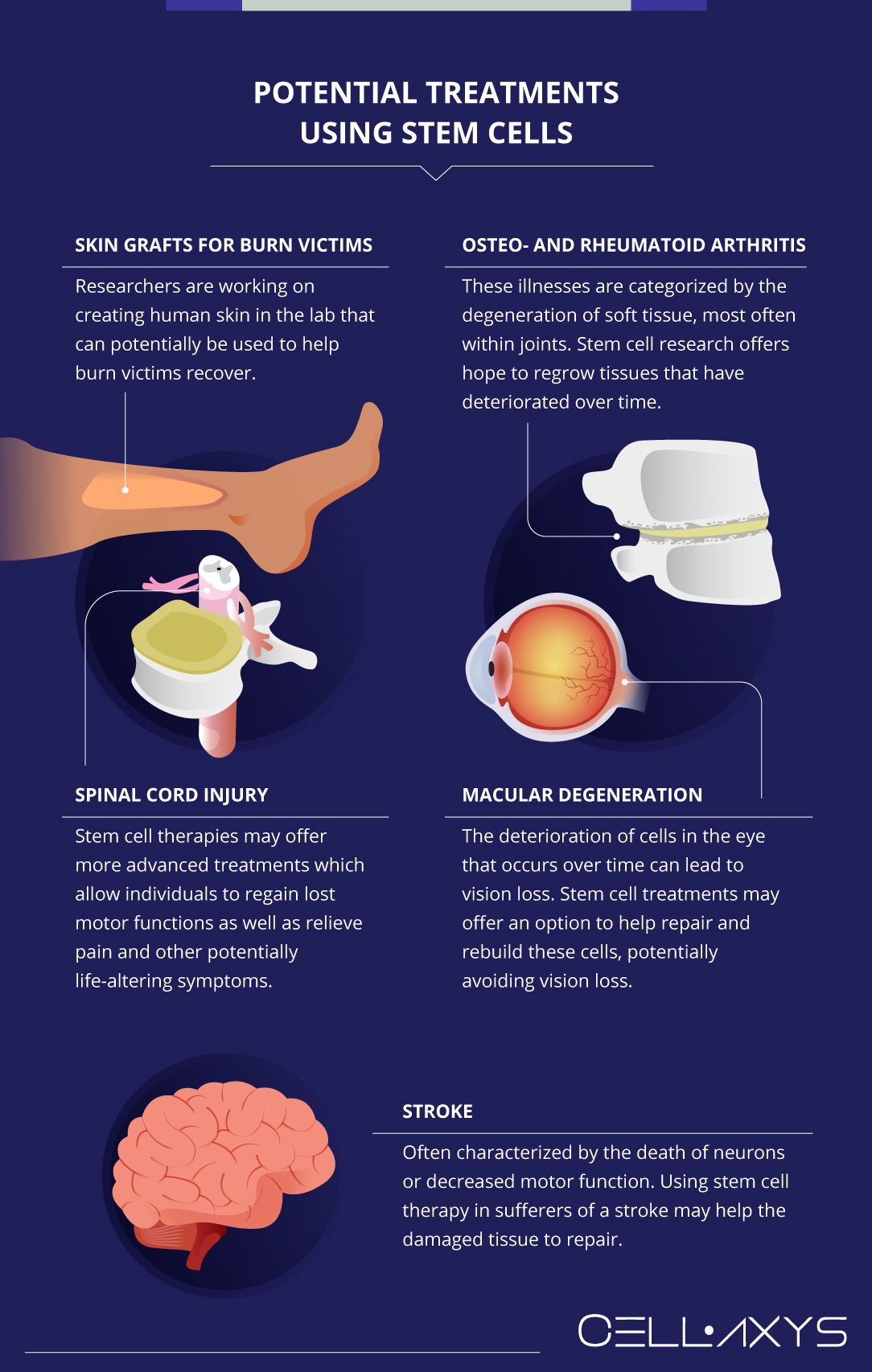 5 Clinical Trials In Stem Cell Science And What They Mean For The