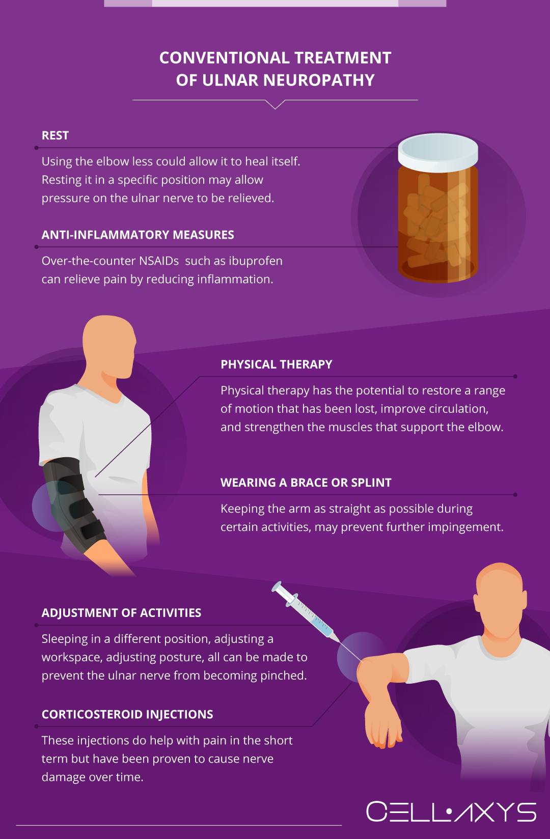 Diagnosis And Treatment Of Ulnar Neuropathy At The Elbow - Cellaxys