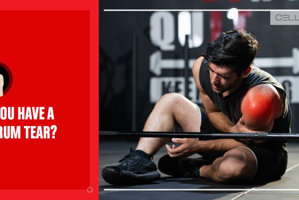 Do You Have a Labrum Tear