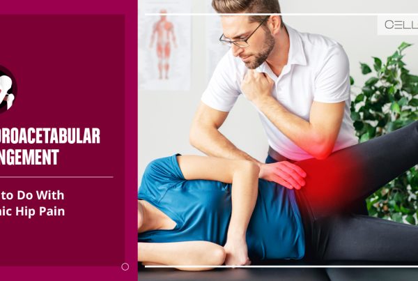 Femoroacetabular Impingement