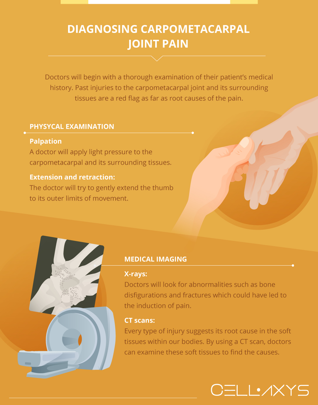 Diagnosing Carpometacarpal Joint Pain