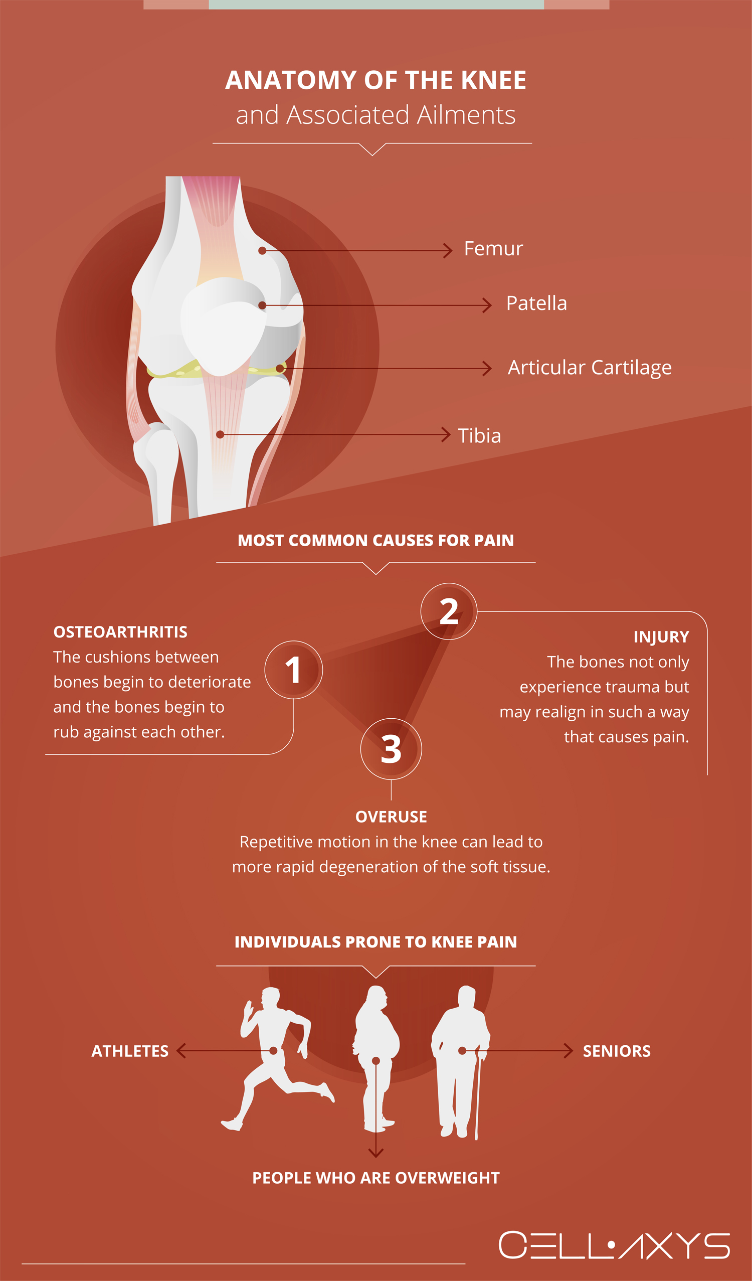 Anatomy of the Knee