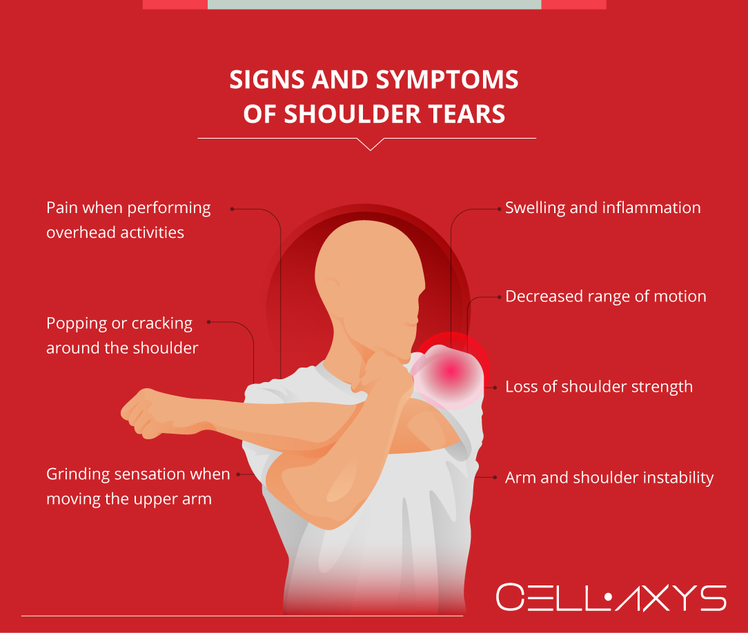 Signs and Symptoms of Shoulder Tears