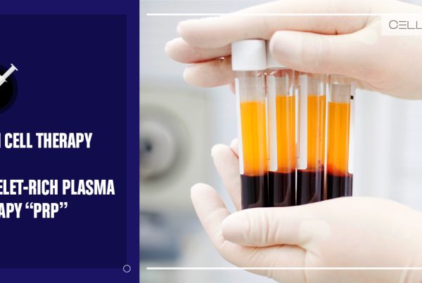 Stem Cell Therapy vs. Platelet-Rich-Plasma Therapy