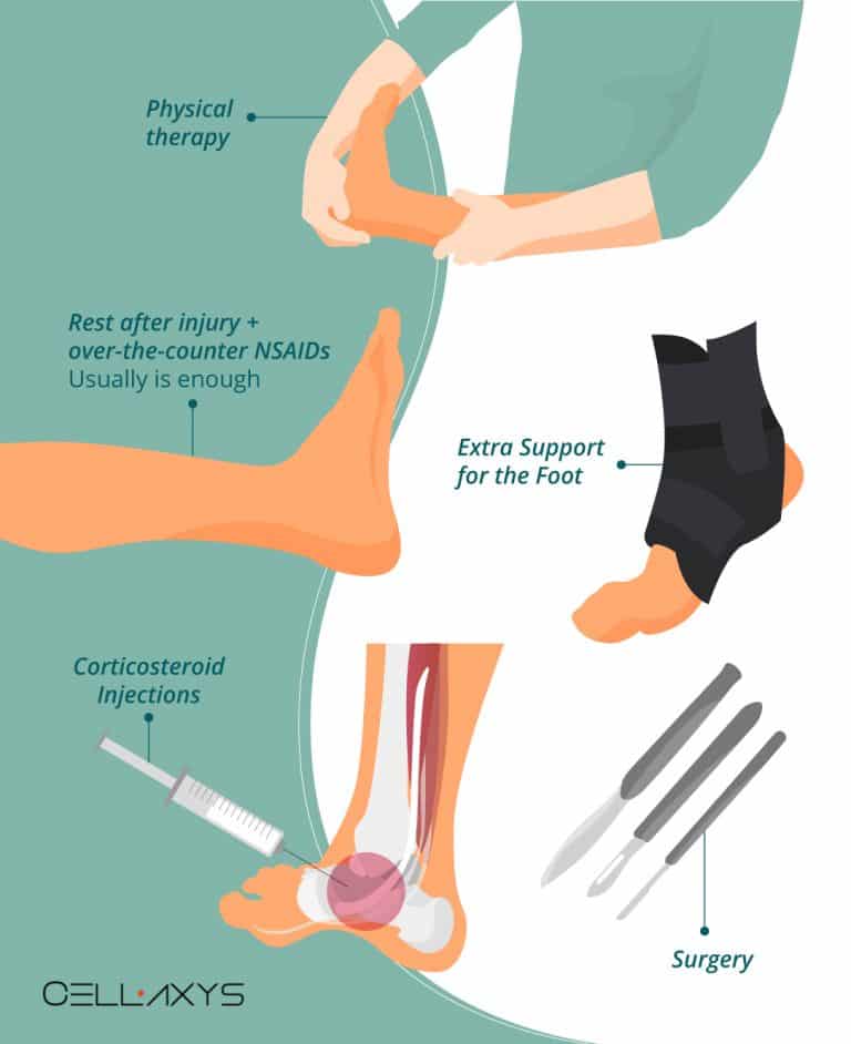 How To Decrease Your Posterior Tibial Tendonitis Recovery Time? - Cellaxys