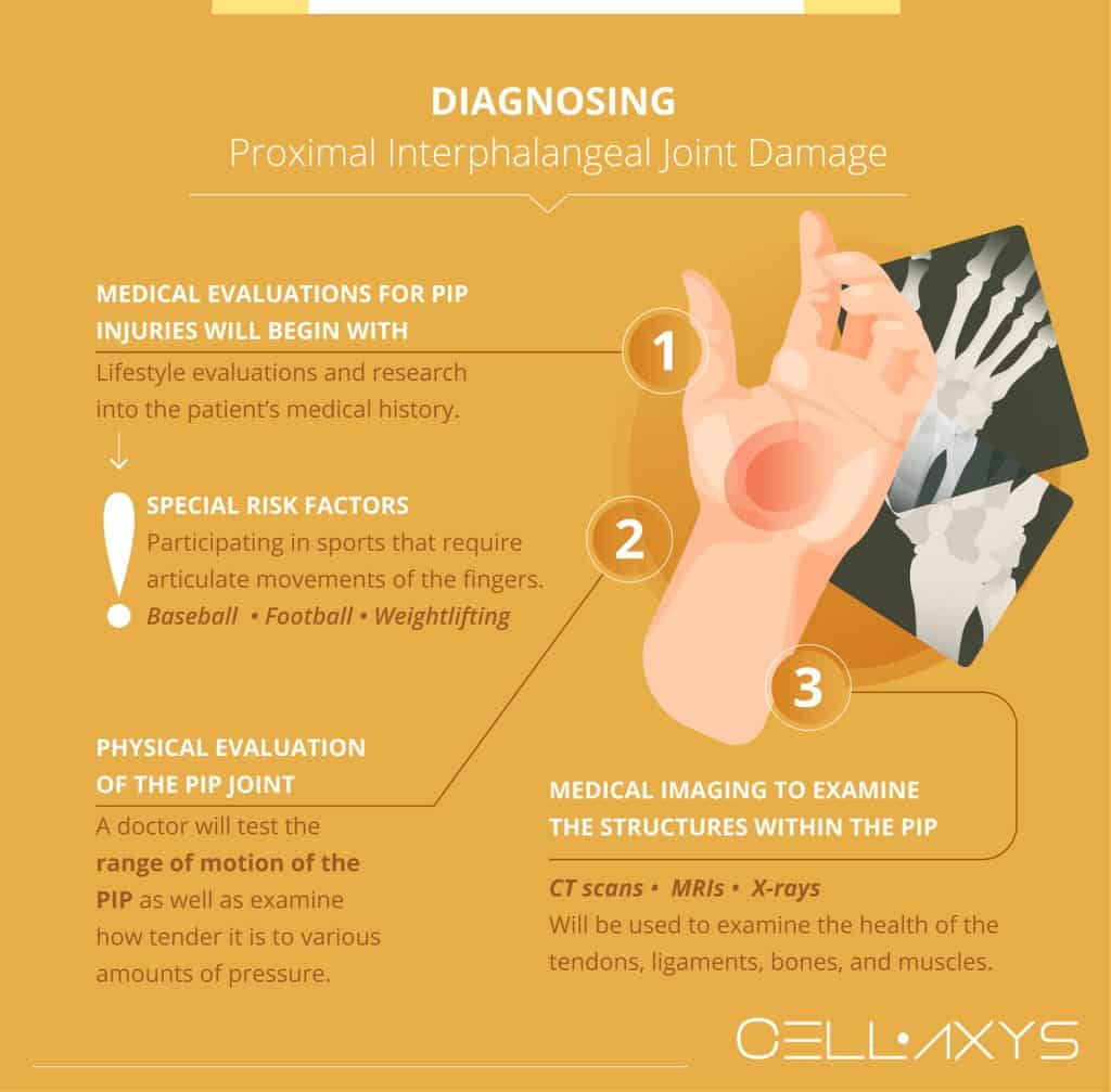 What To Do About Proximal Interphalangeal (PIP) Joint Pain? - Cellaxys