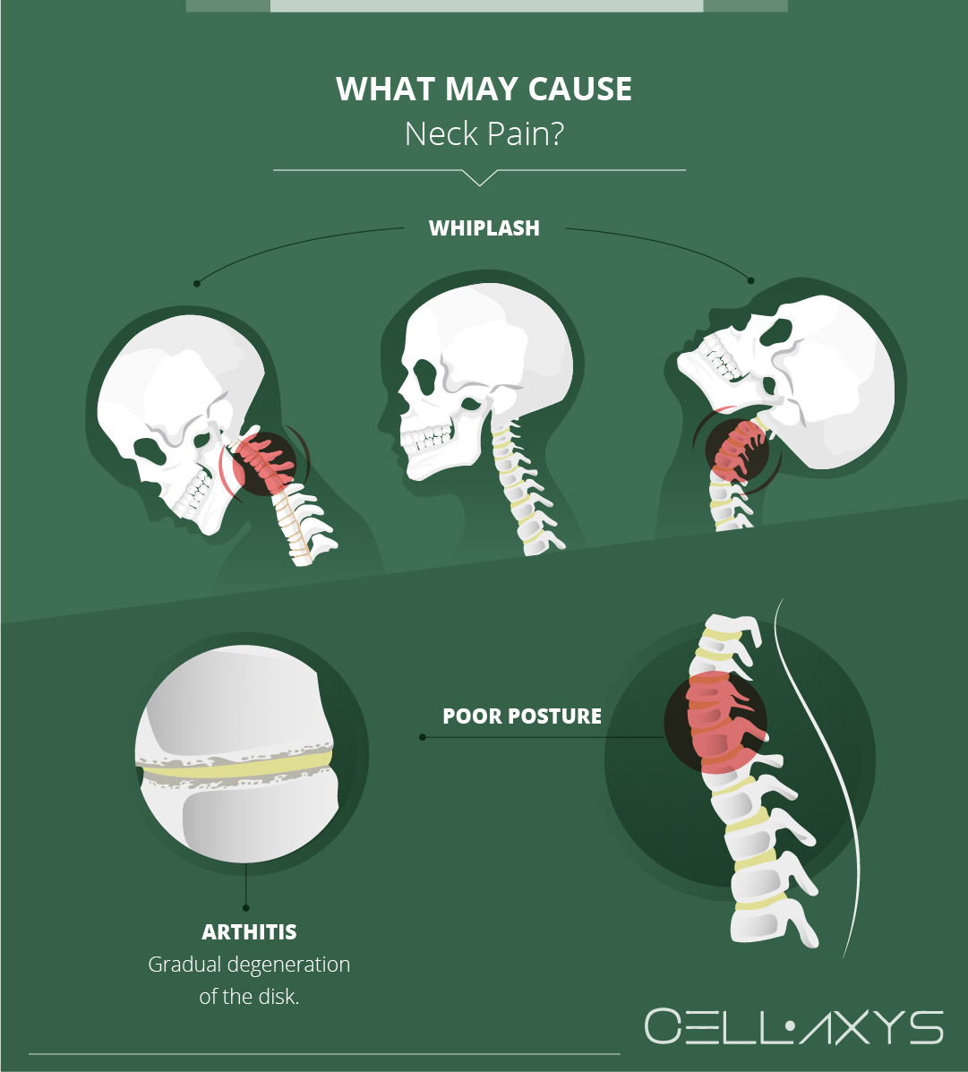 A Stiff Neck Weak Stomach How Neck Pain Can Cause Nausea Cellaxys