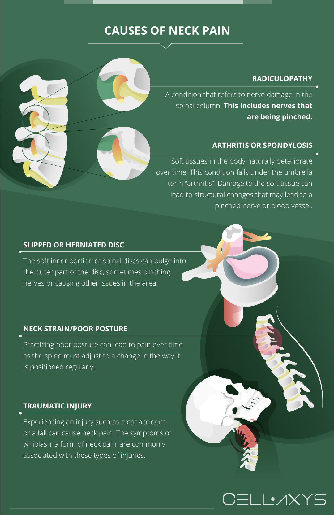 Neck Tension: Causes, Symptoms, and Treatments