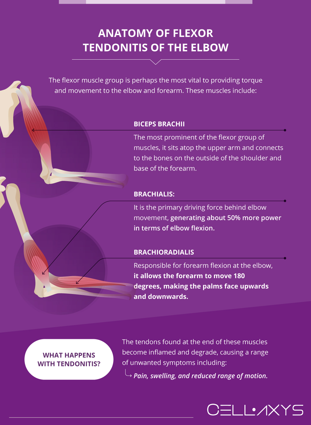 Flexor Tendonitis Of The Elbow Anatomy Symptoms Causes Treatments 