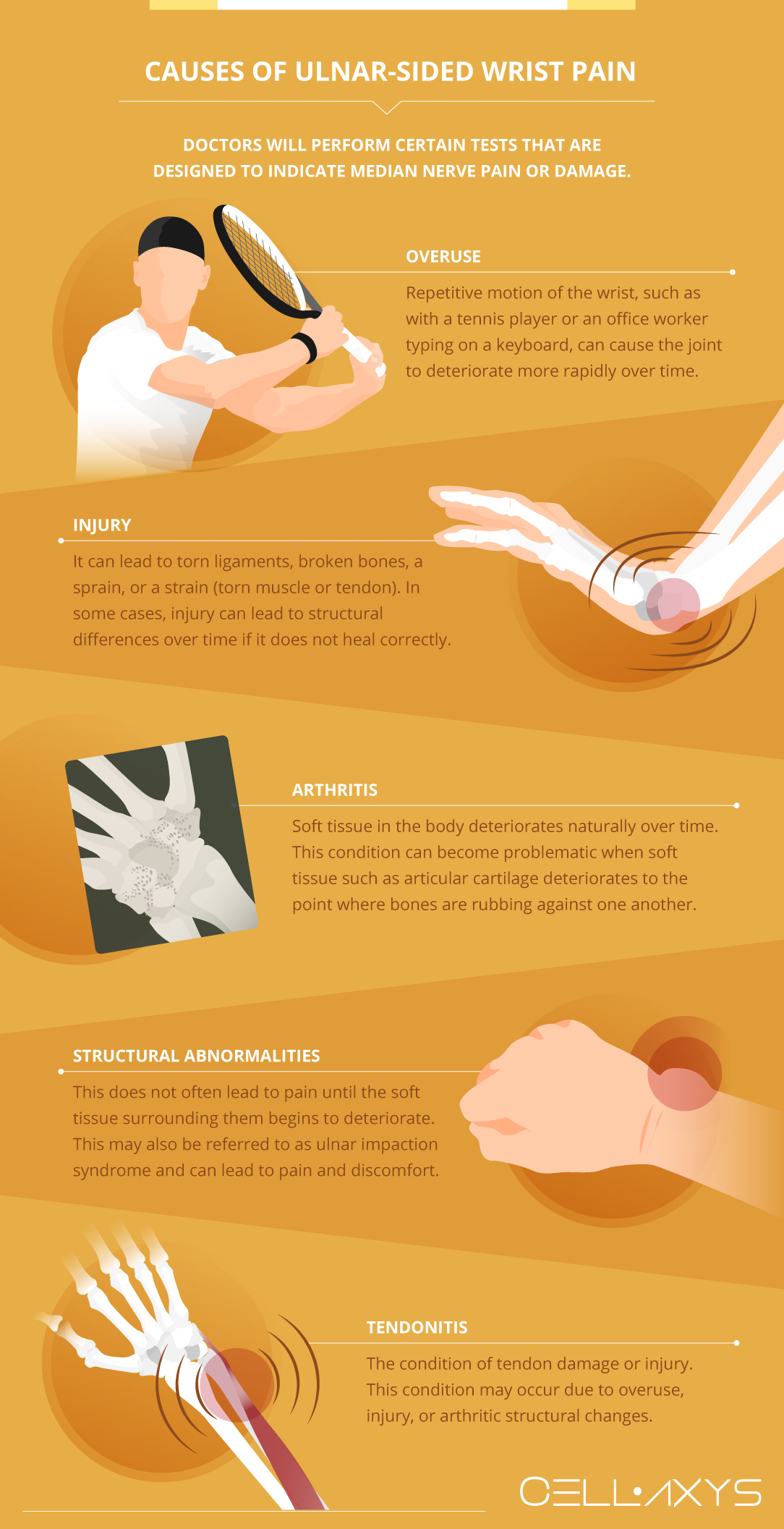 Causes of Ulnar-Sided Wrist Pain