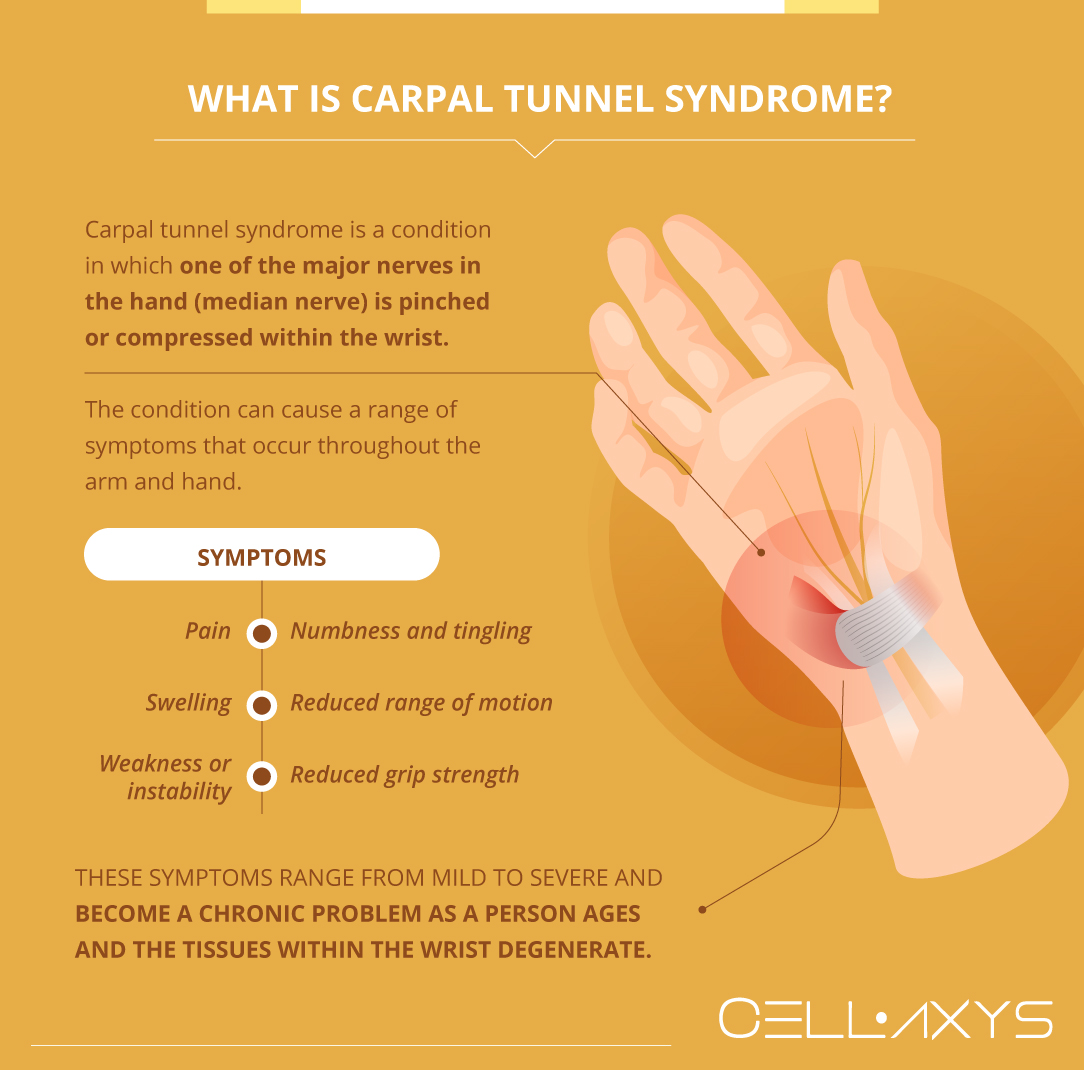 What Is Carpal Tunnel Syndrome