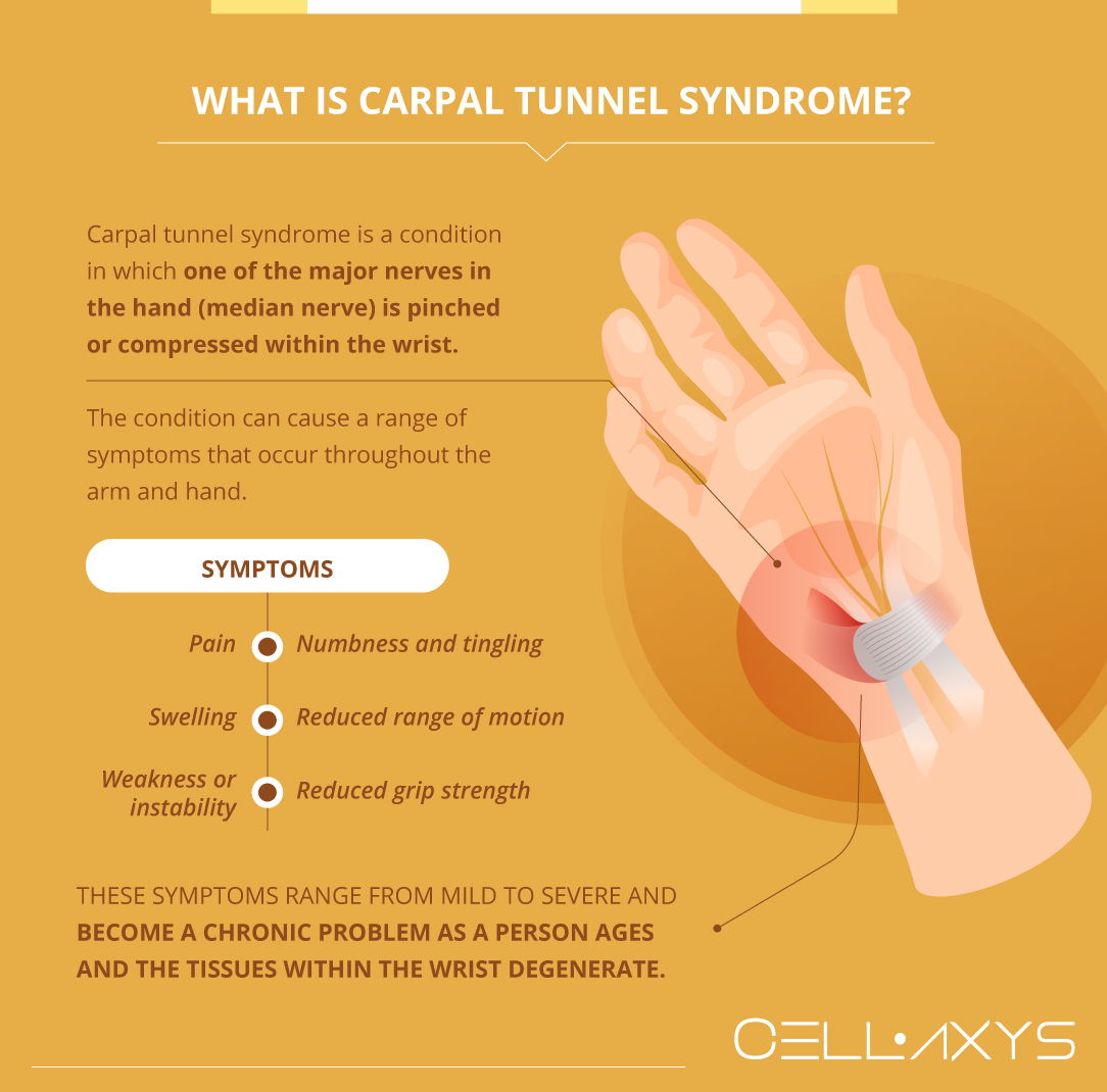 Six Tips For Carpal Tunnel Pain Relief Without Surgery » INSIGHT