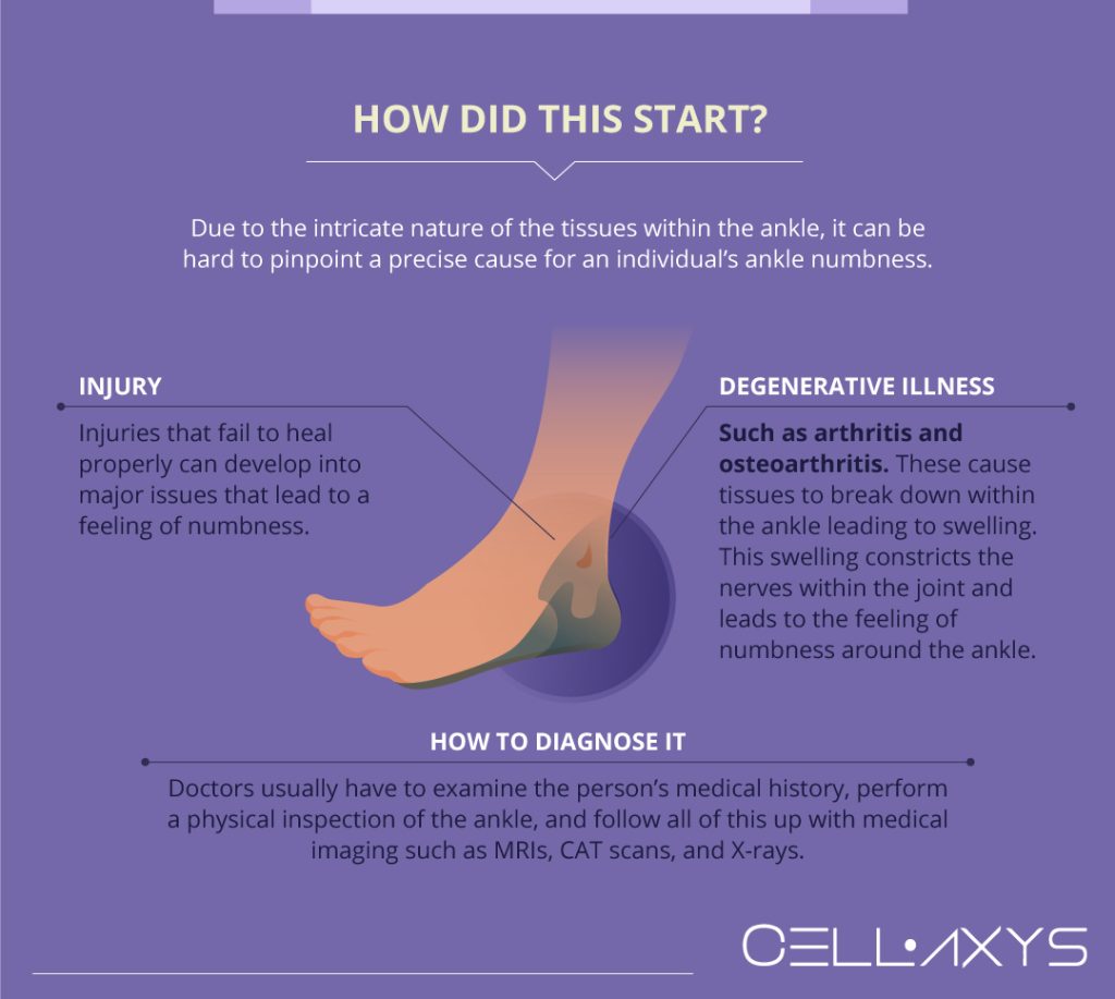 Numb Ankles And The Degenerative Illnesses They Can Preclude - Cellaxys