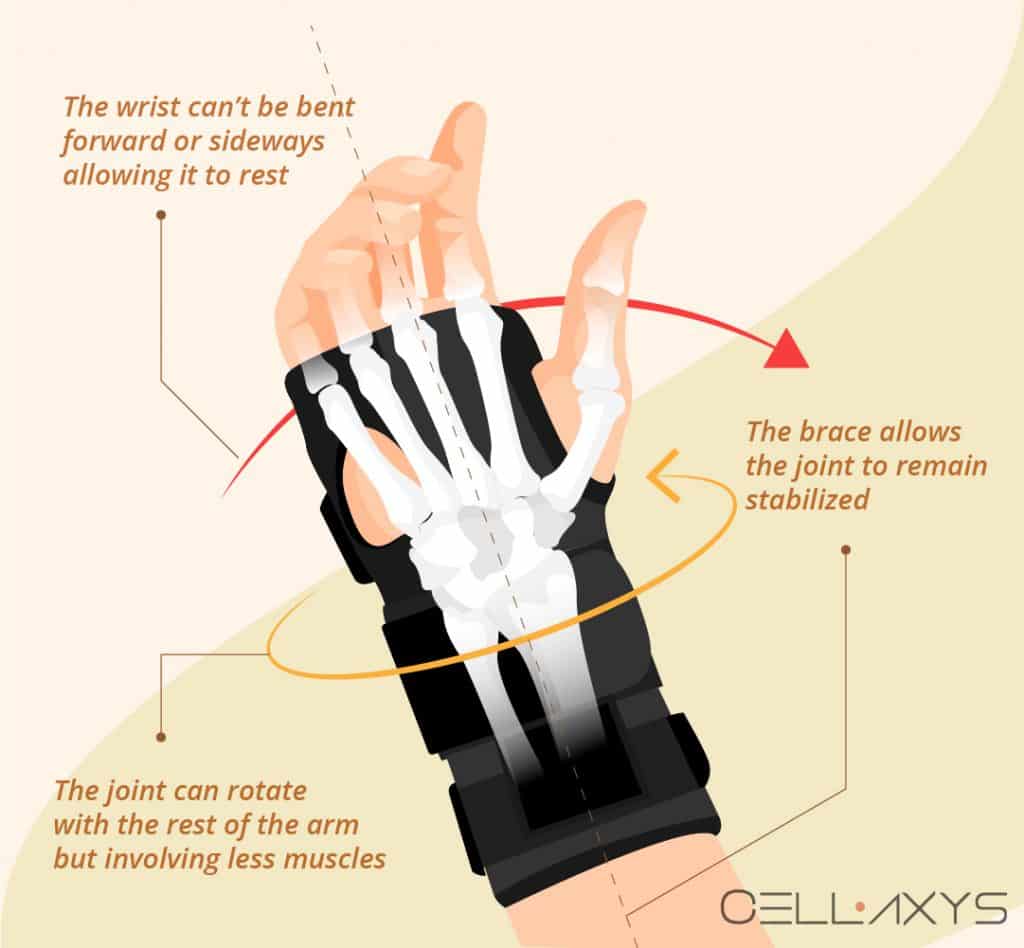 How To Manage Ulnar-Sided Wrist Pain With A Brace? - Cellaxys