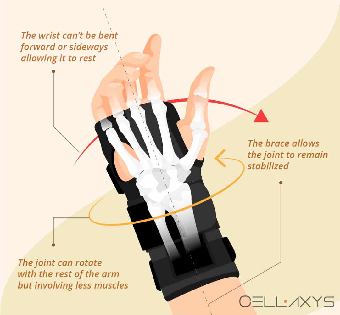 How To Manage UlnarSided Wrist Pain With A Brace? Cellaxys