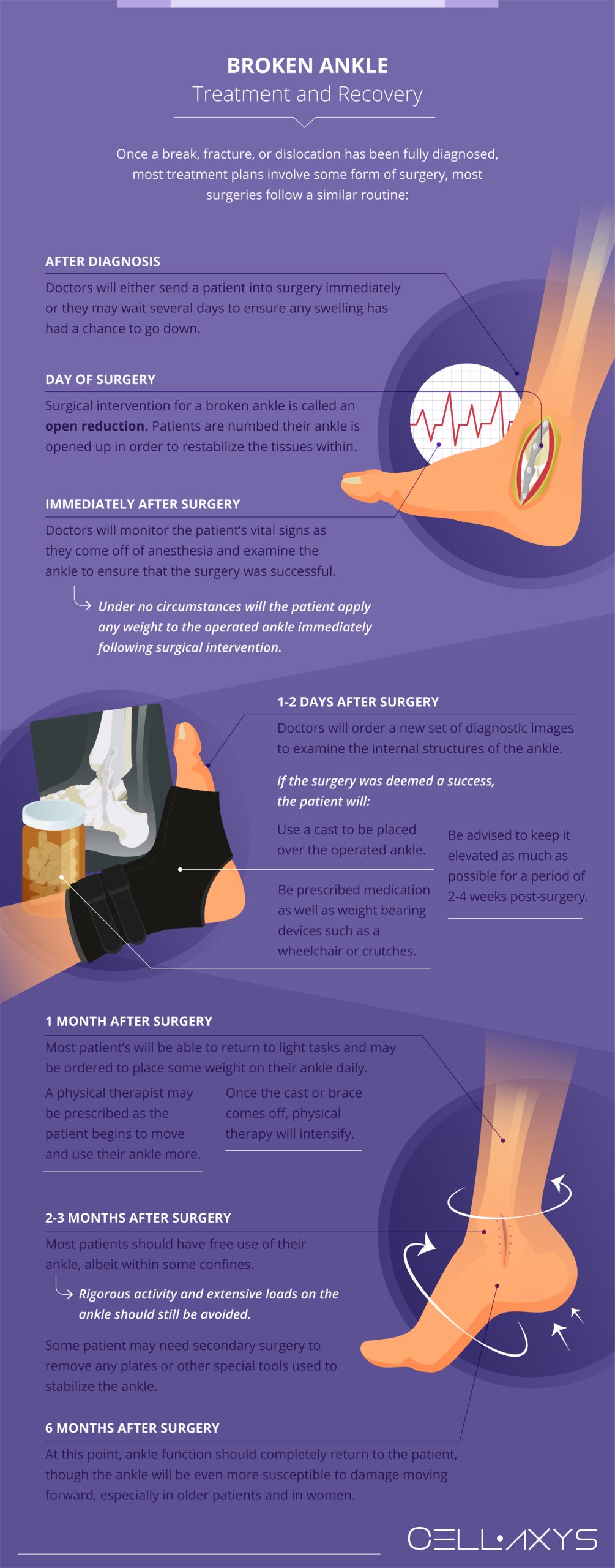 Ankle Fracture Open Reduction and Internal Fixation | Johns Hopkins Medicine