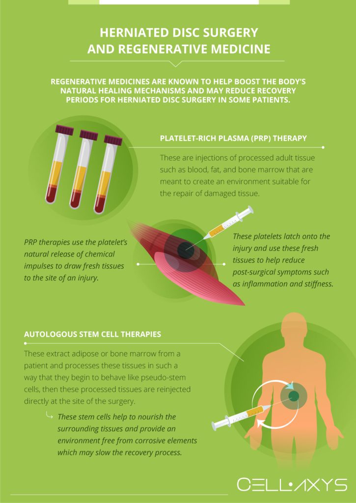 Herniated Disc Recovery Time Cellaxys