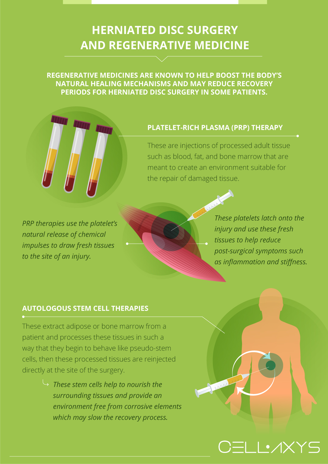https://cellaxys.com/wp-content/uploads/2019/12/Herniated-Disc-Recovery-Time-1.jpeg