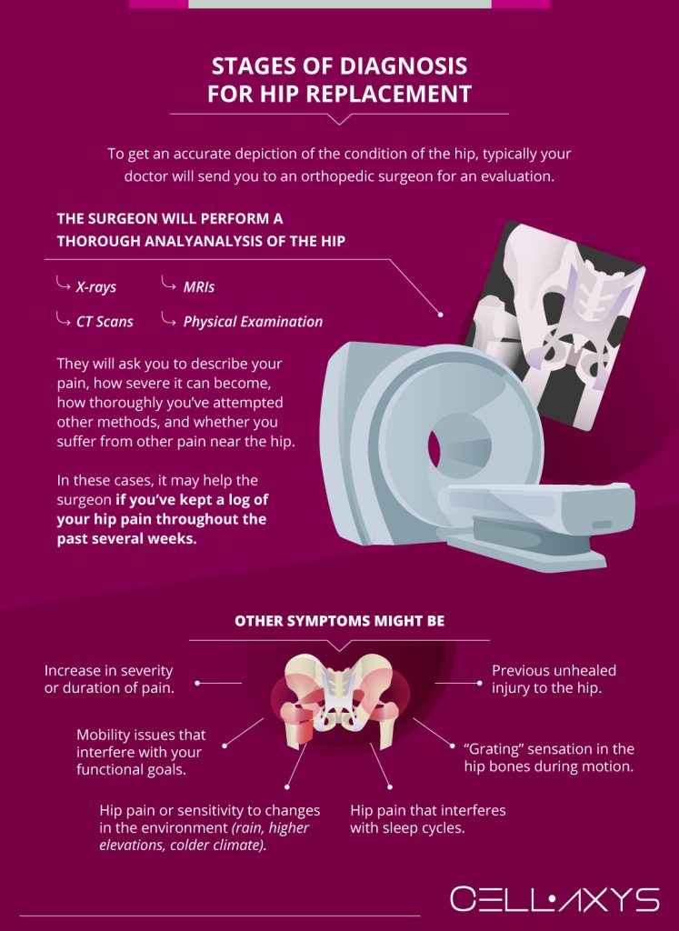 Hip Replacement Recovery Time Cellaxys