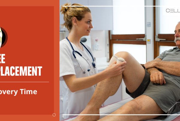 Knee Replacement Recovery Time