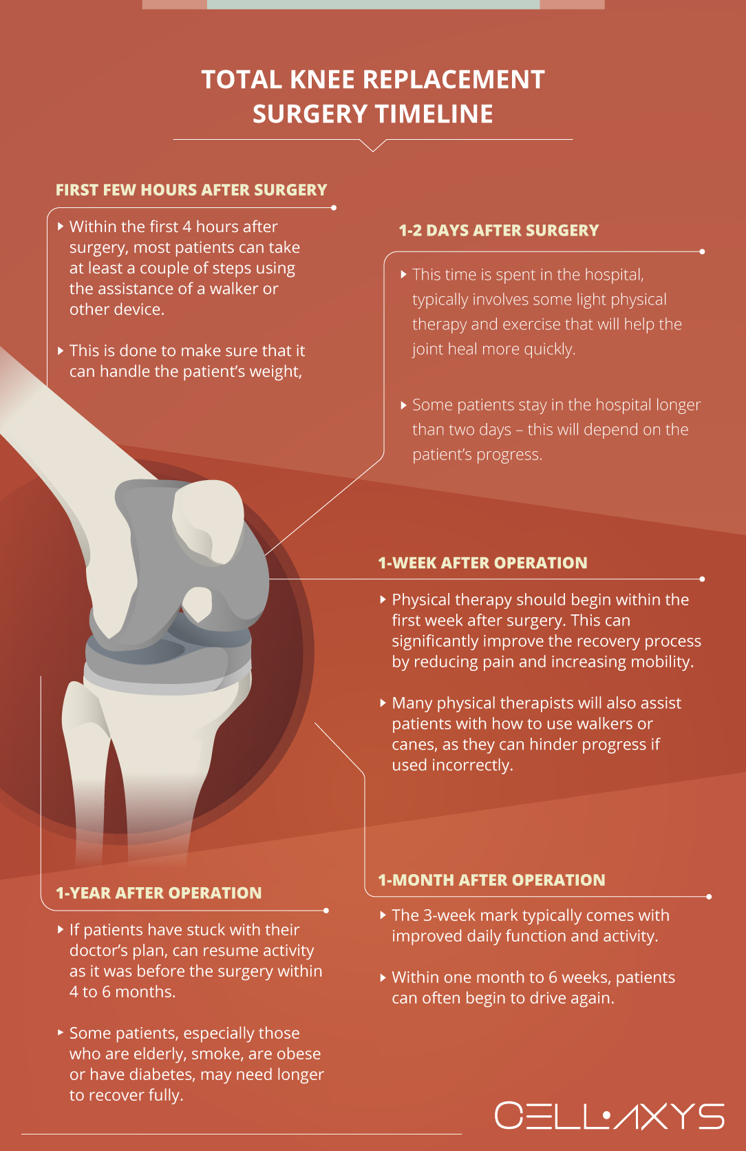 Total Knee Replacement Surgery Timeline
