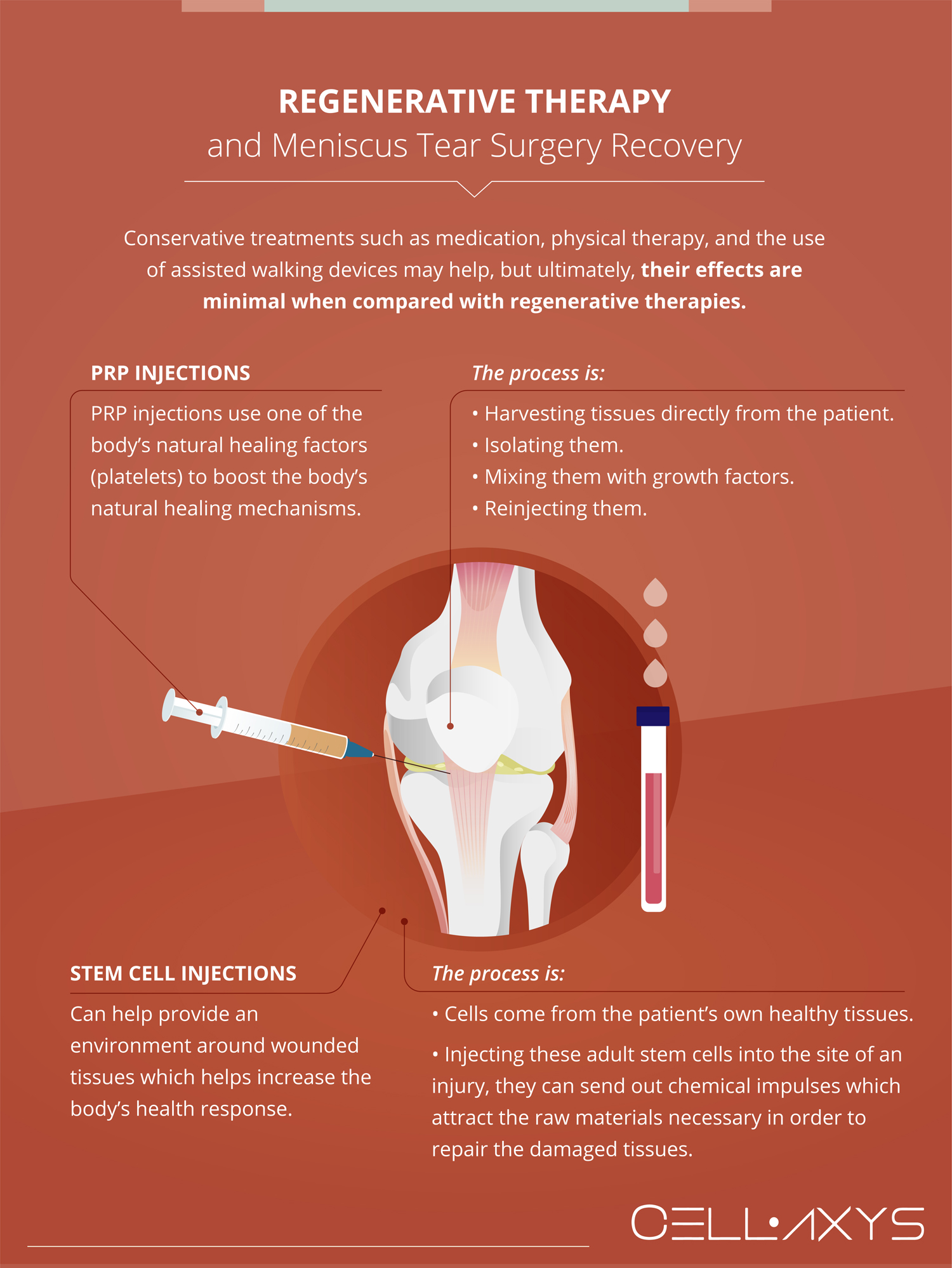 Torn Meniscus - Repair and Post Op Instructions - Connecticut