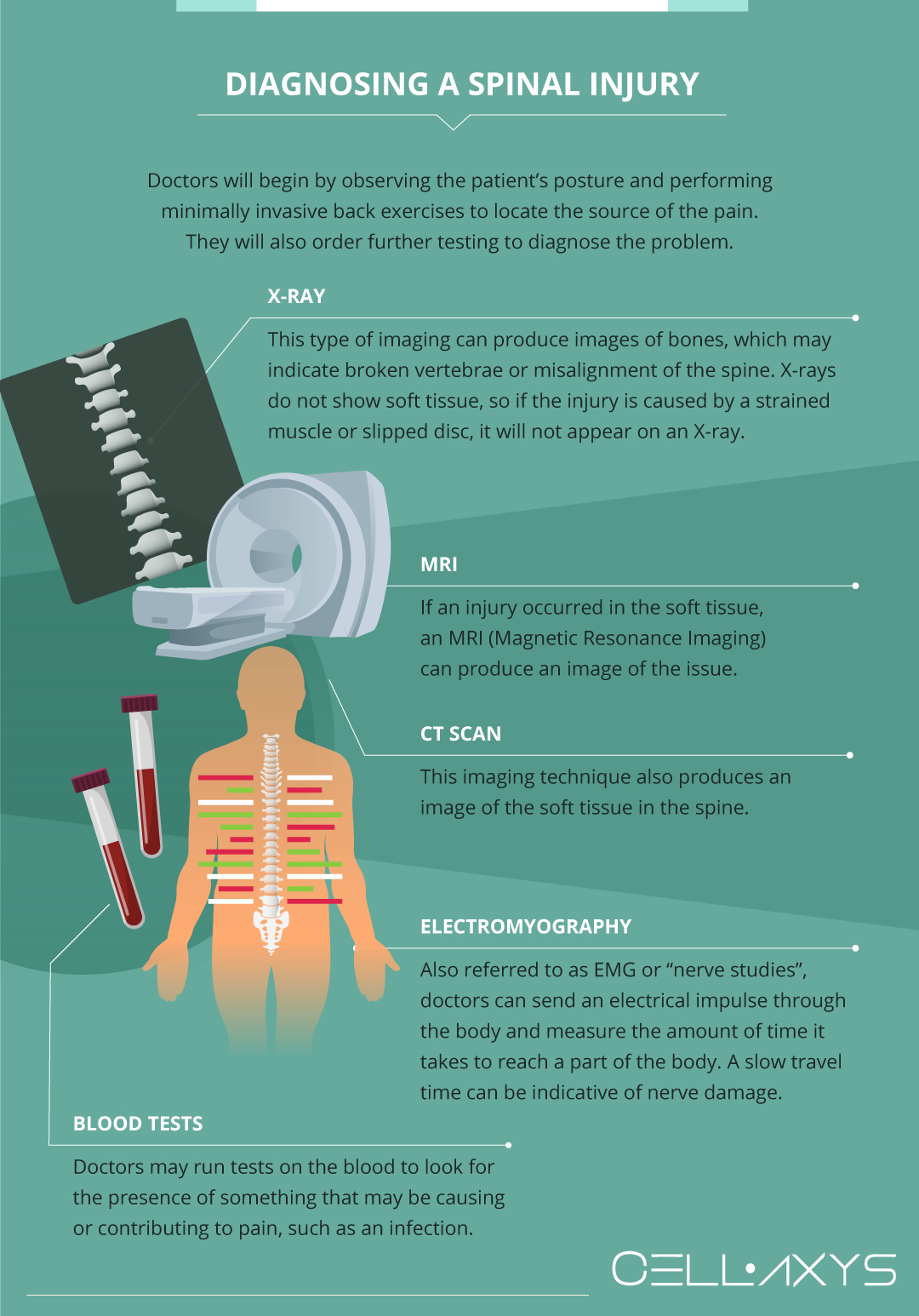 What is the recovery time for upper back surgery?