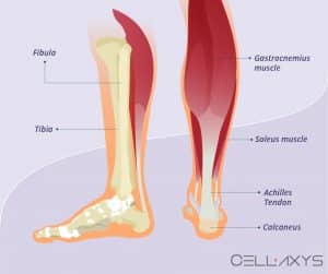 Calf Strain Recovery Time - Cellaxys