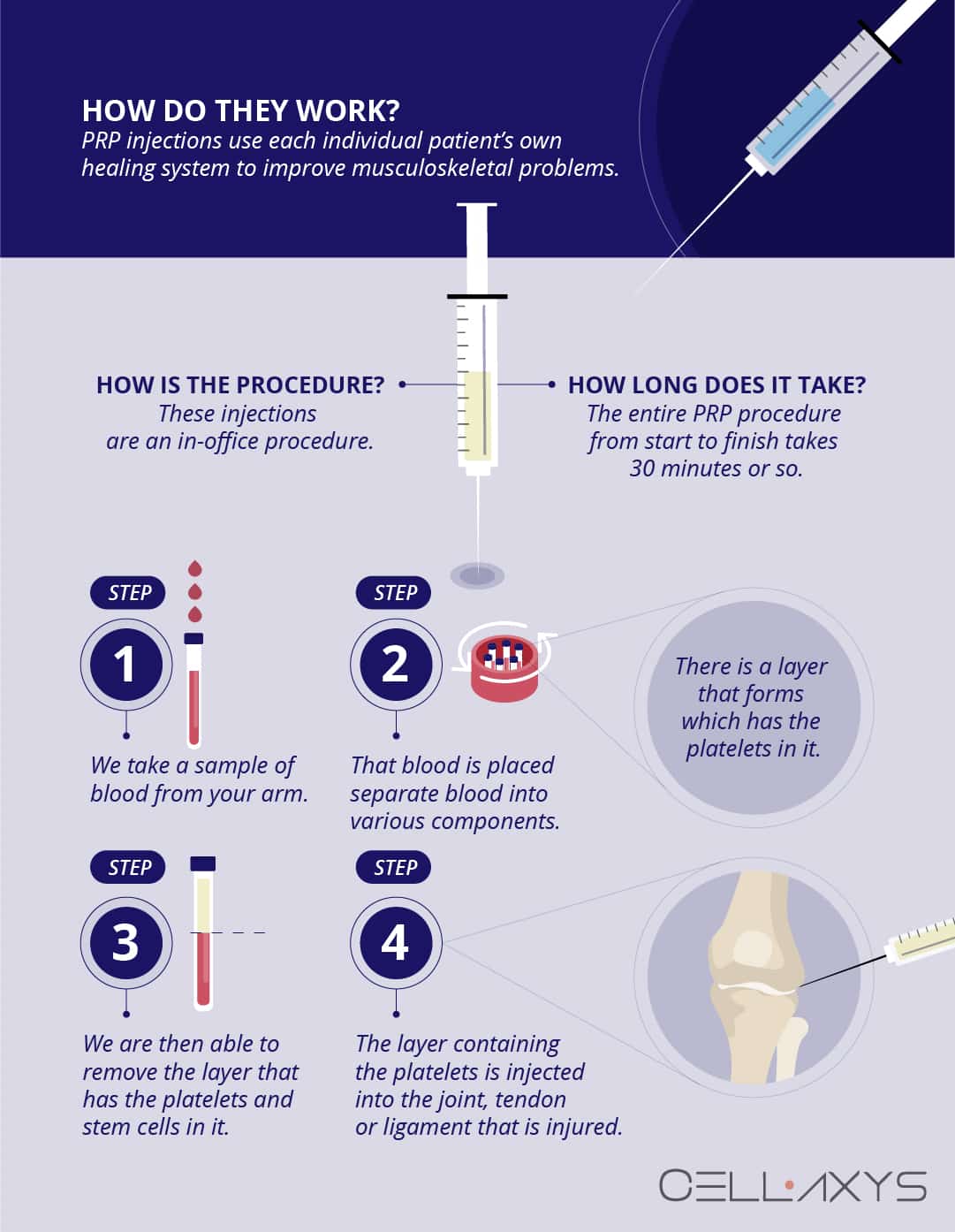 PRP injection process