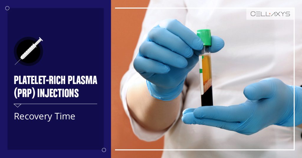Platelet-Rich Plasma