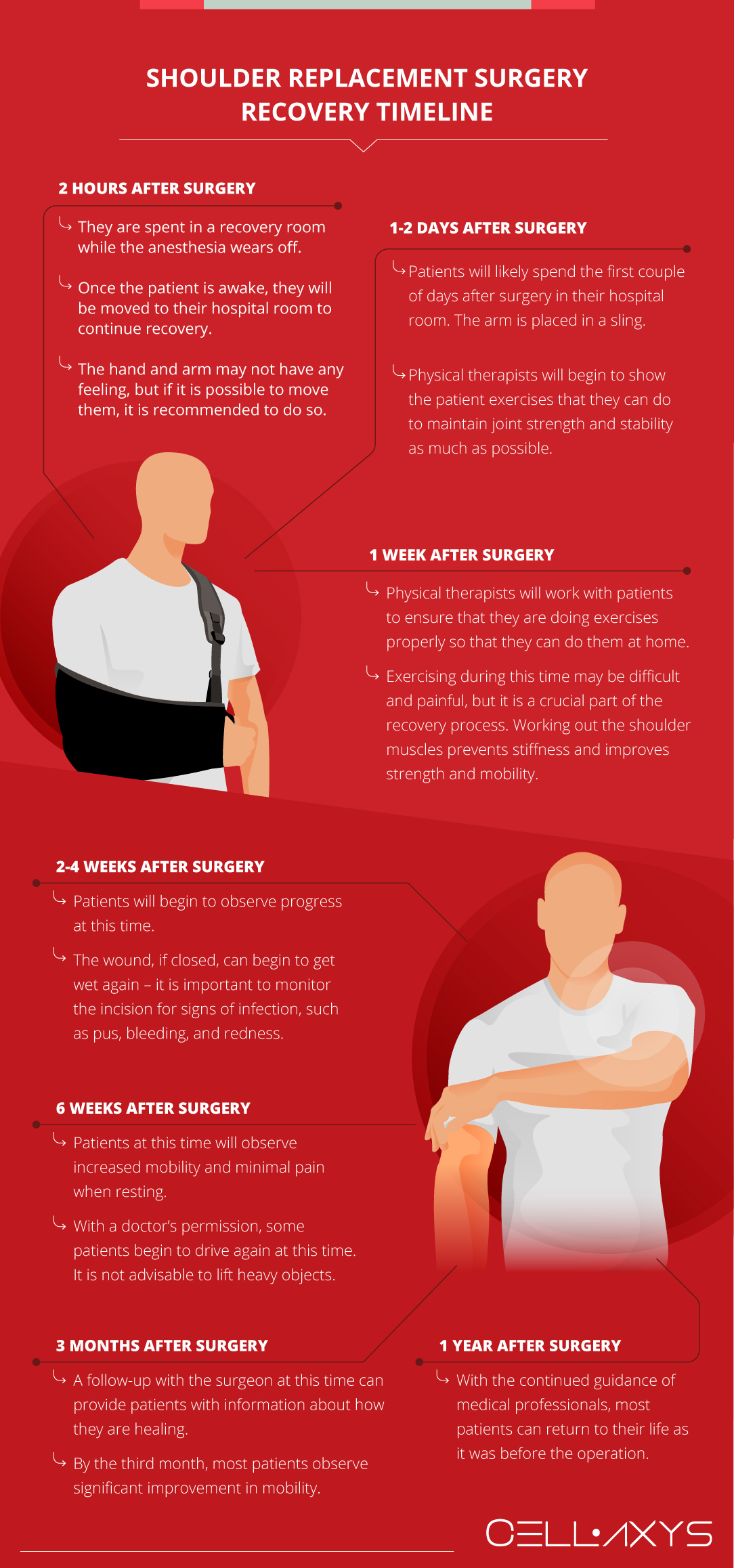 Shoulder Replacement Surgery Recovery Timeline