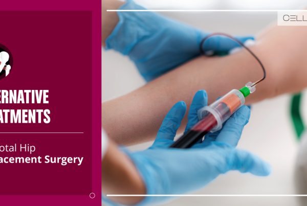Total Hip Replacement Surgery
