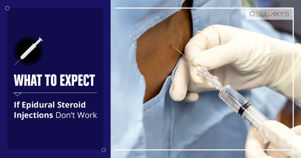 What to Expect if Epidural Steroid Injections Don't Work