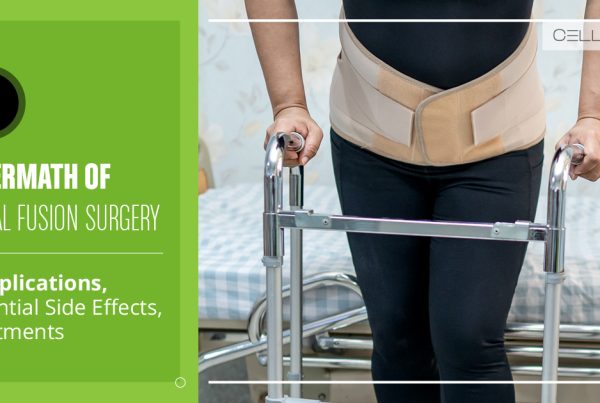 Aftermath of Spinal Fusion Surgery