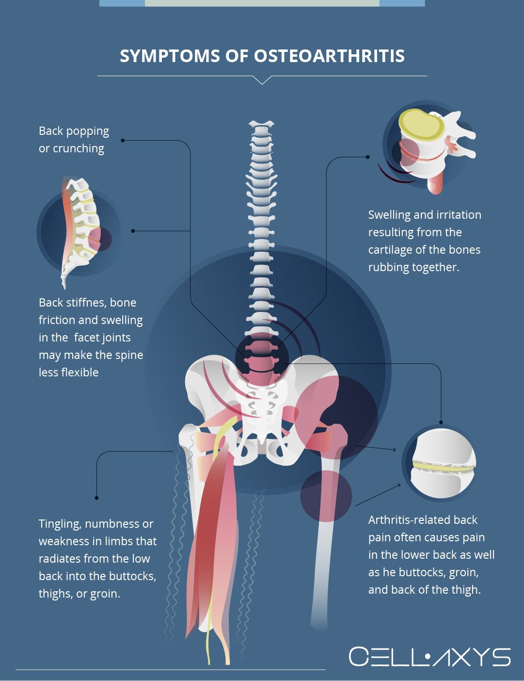 How Can Tight Muscles Result In Back Pain? - Cellaxys