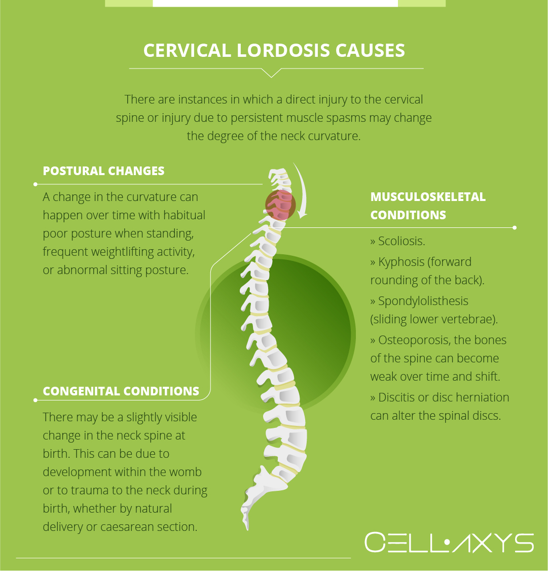 loss of lumbar lordosis due to muscle spasm