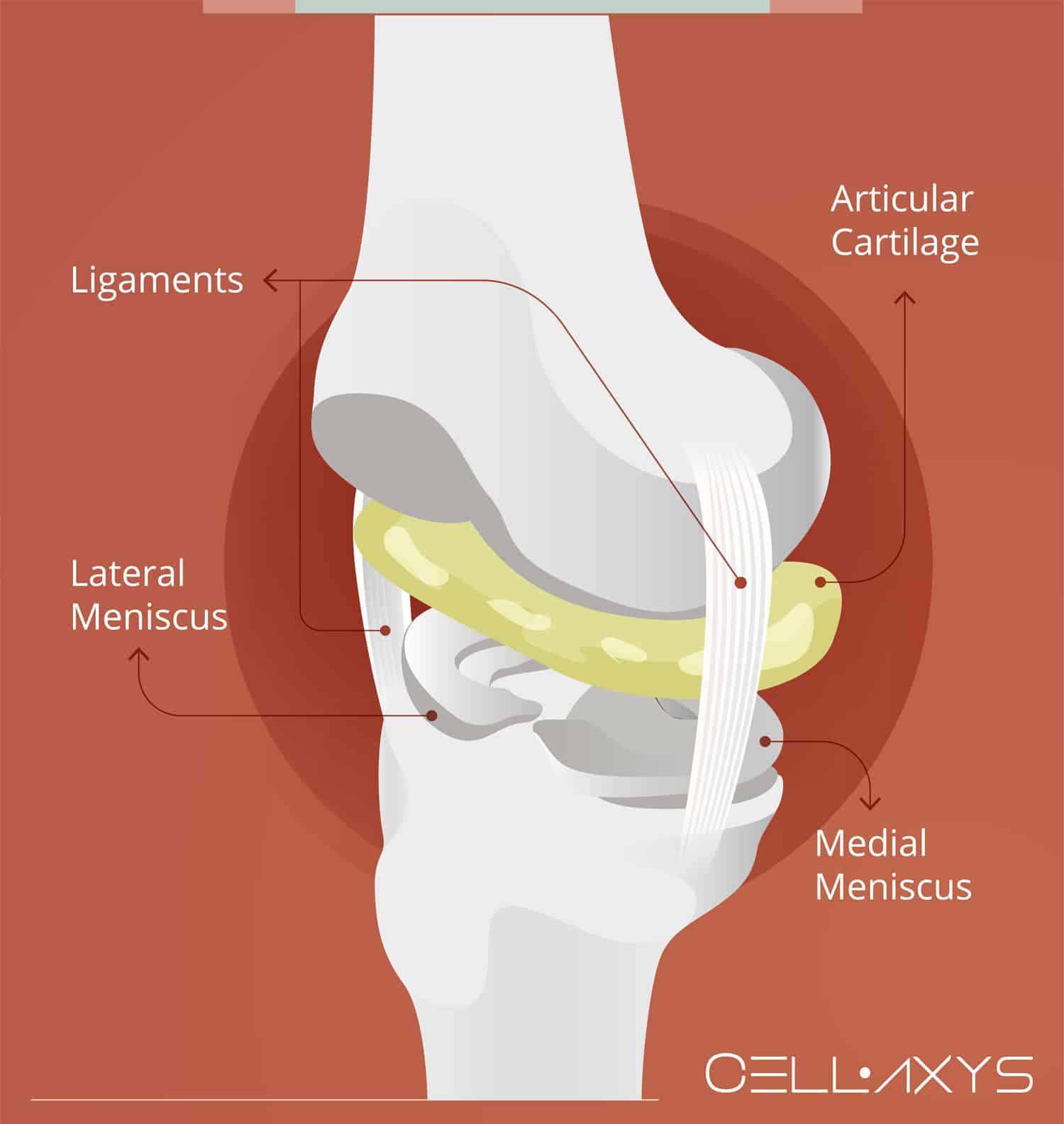 Knee Meniscus Tear Surgery