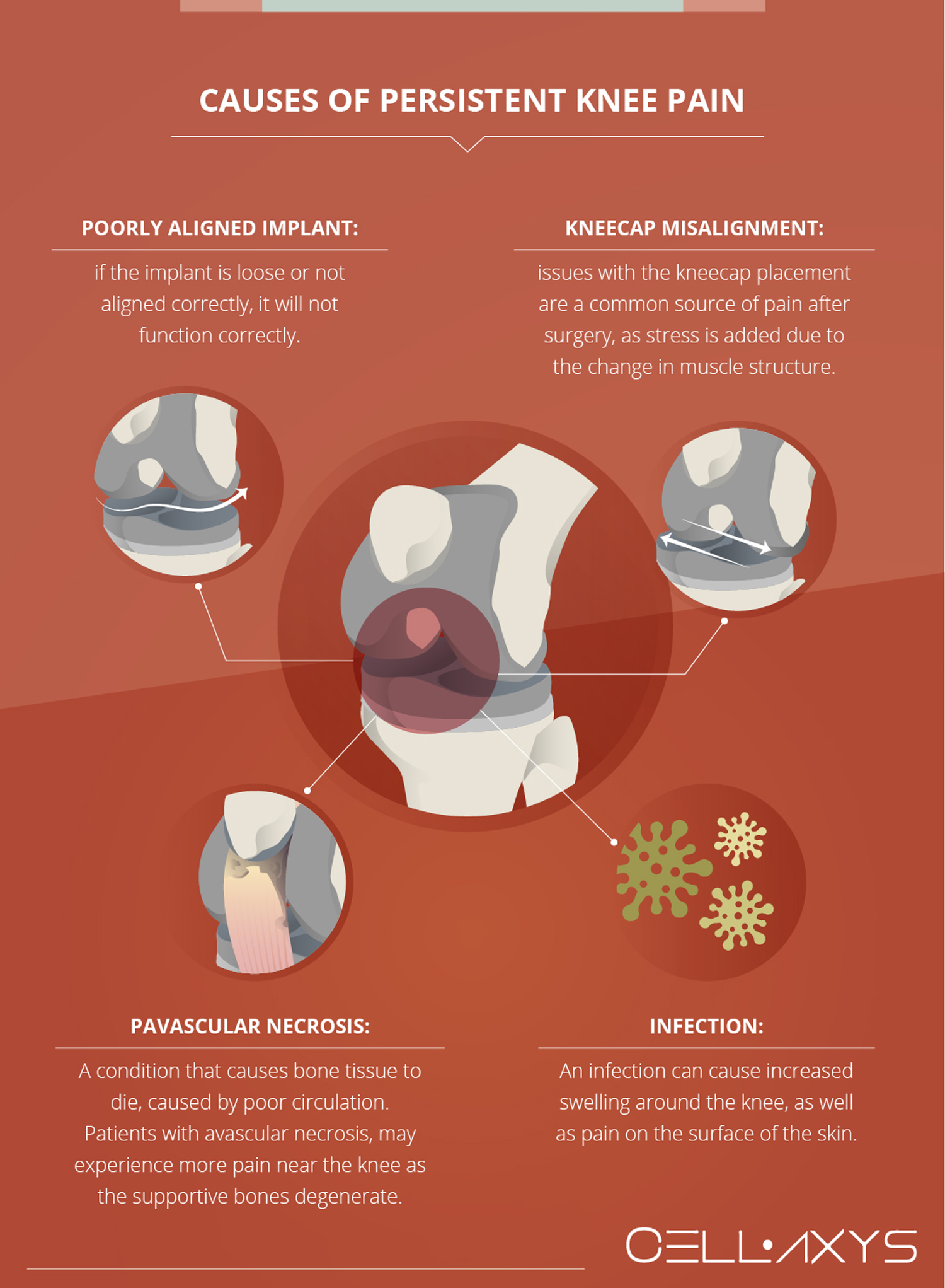 Causes of Persistent Knee Pain