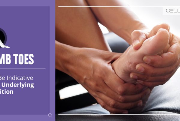 Numb Toes May be Indicative of an Underlying Condition