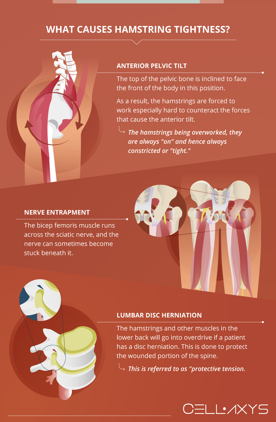 Knee Pain Can Tight Hamstrings Cause Knee Pain Cellaxys